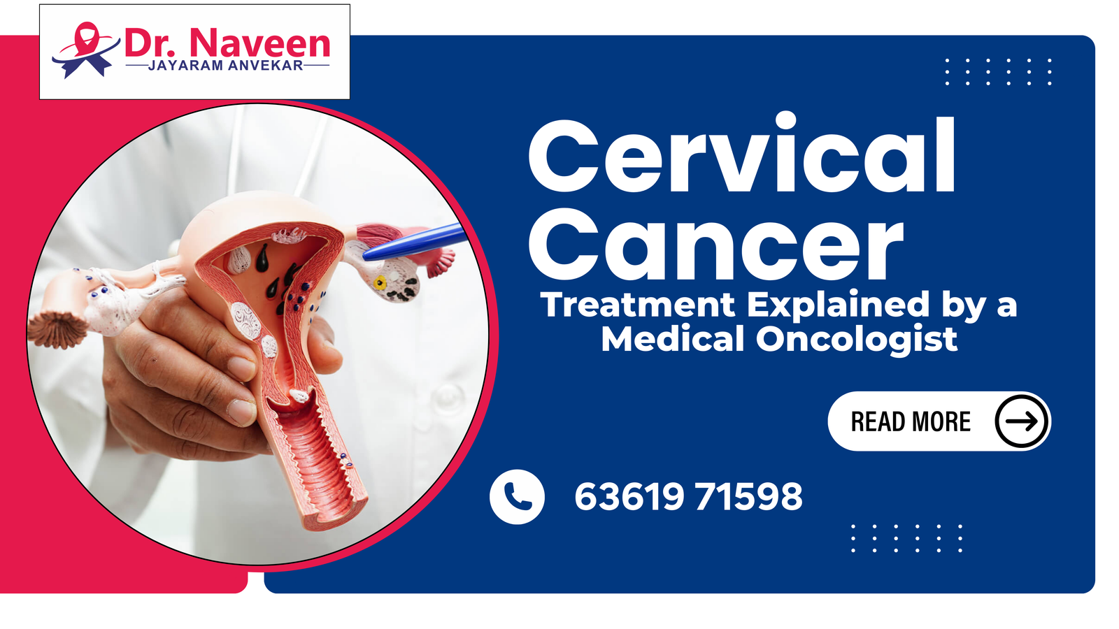 Cervical Cancer